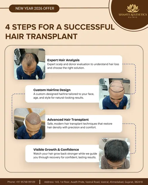 Hair Transplant - Shanti Aesthetic — Shanti Aesthetic Clinic