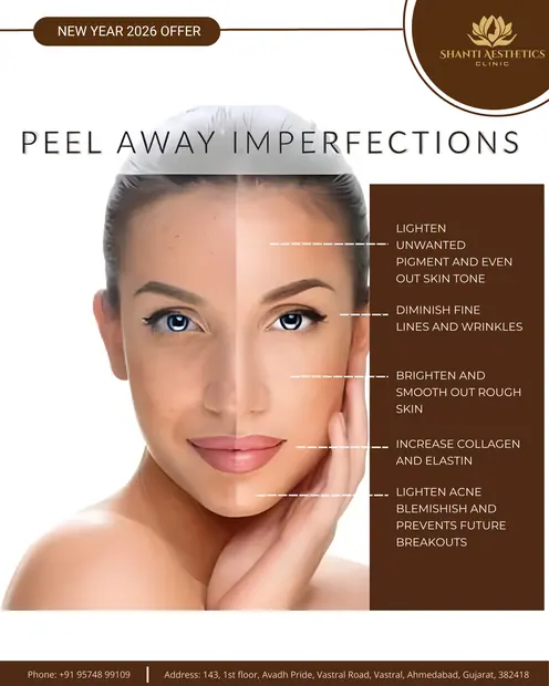 PEEL AWAY IMPERFECTIONS- SHANTI CLINIC — Shanti Aesthetic Clinic